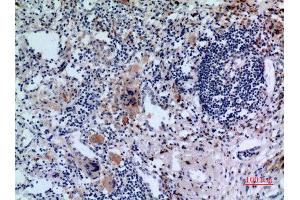 Immunohistochemistry (IHC) analysis of paraffin-embedded Human Lung, antibody was diluted at 1:100. (Transferrin Receptor antibody  (N-Term))