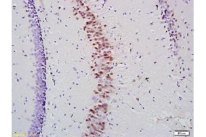 Formalin-fixed and paraffin embedded mouse hippocampus labeled with Anti- KLK10 Polyclonal Antibody, Unconjugated (ABIN741630) at 1:200 followed by conjugation to the secondary antibody (Kallikrein 10 antibody  (AA 65-165))