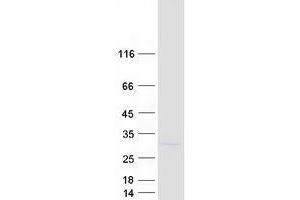 Western Blotting (WB) image for TP53RK Binding Protein (TPRKB) protein (Myc-DYKDDDDK Tag) (ABIN2734102)