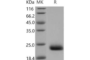 C-Type Lectin Domain Family 6, Member A (CLEC6A) (Active) protein (His tag)