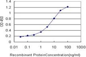 Detection limit for recombinant GST tagged PIM1 is approximately 0. (PIM1 antibody  (AA 1-100))