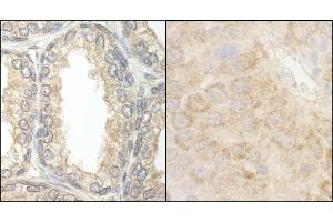 Immunohistochemistry (IHC) image for anti-BCL2-Associated Agonist of Cell Death (BAD) (AA 1-50) antibody (ABIN7453524)