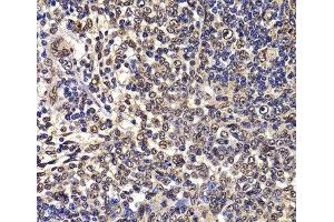 Immunohistochemistry of paraffin-embedded Rat spleen using WBSCR22 Polyclonal Antibody at dilution of 1:100 (40x lens). (WBSCR22 antibody)