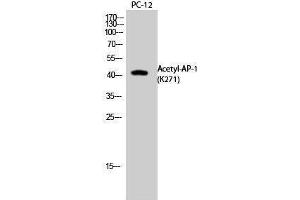 Western Blotting (WB) image for anti-Jun Proto-Oncogene (JUN) (acLys271) antibody (ABIN3181391) (C-JUN antibody  (acLys271))