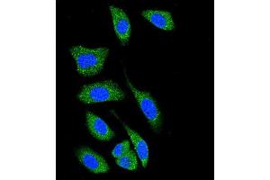 Confocal immunofluorescent analysis of D Kinase 1 (DK1) Antibody (C-term) 7217b with A549 cell followed by Alexa Fluor® 489-conjugated goat anti-rabbit lgG (green). (DAP Kinase 1 antibody  (C-Term))