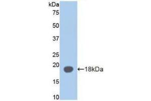 Detection of Recombinant aZGP1, Mouse using Polyclonal Antibody to Alpha-2-Glycoprotein 1, Zinc Binding (aZGP1)