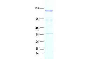 Validation with Western Blot
