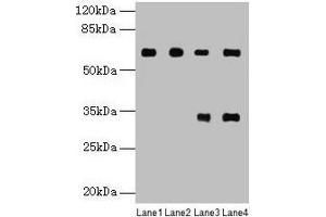 Western blot All lanes: PGM1 antibody at 6 μg/mL Lane 1: U251 whole cell lysate Lane 2: U937 whole cell lysate Lane 3: Jurkat whole cell lysate Lane 4: Hela whole cell lysate Secondary Goat polyclonal to rabbit IgG at 1/10000 dilution Predicted band size: 62, 64, 41 kDa Observed band size: 62 kDa (Phosphoglucomutase 1 antibody  (AA 1-562))