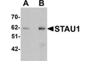 Western blot analysis of STAU1 in rat brain tissue lysate with STAU1 antibody at (A) 1 and (B) 2 μg/ml.