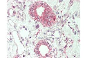 Human Kidney: Formalin-Fixed, Paraffin-Embedded (FFPE) (MICAL1 antibody)
