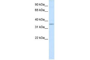 WB Suggested Anti-TGIFX1 Antibody Titration:  0.