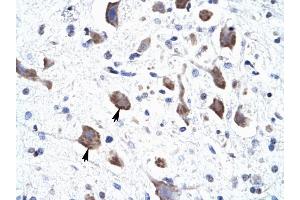 CLCN3 antibody was used for immunohistochemistry at a concentration of 4-8 ug/ml to stain Neural cells (arrows) in Human Brain. (CLCN3 antibody  (C-Term))