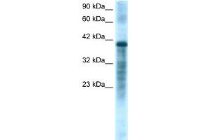 WB Suggested Anti-PSMC3 Antibody Titration:  1. (PSMC3 antibody  (Middle Region))