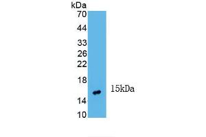 Detection of Recombinant INHbA, Human using Monoclonal Antibody to Inhibin Beta A (INHbA) (INHBA antibody  (AA 311-426))