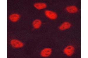 ABIN6267678 staining HUVEC cells by ICC/IF. (ESR2 antibody  (pSer105))