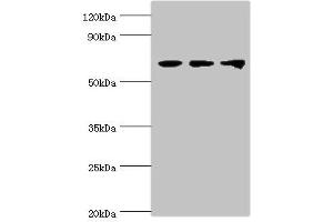 Western blot All lanes: Probable ATP-dependent RNA helicase DDX5 antibody at 3 μg/mL Lane 1: NIH/3T3 whole cell lysate Lane 2: Hela whole cell lysate Lane 3: 293T whole cell lysate Secondary Goat polyclonal to rabbit IgG at 1/10000 dilution Predicted band size: 70, 61 kDa Observed band size: 70 kDa (DDX5 antibody  (AA 1-290))