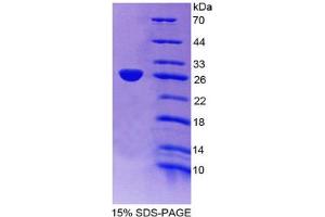 SDS-PAGE analysis of Mouse Apolipoprotein A4 Protein.