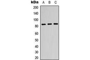Western blot analysis of Beta-glucuronidase expression in K562 (A), HeLa (B), HepG2 (C) whole cell lysates. (Glucuronidase beta antibody  (Center))