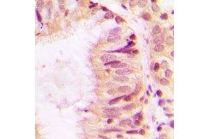 Immunohistochemistry (IHC) image for anti-Serpin Family H Member 1 (SERPINH1) antibody (ABIN7308322) (SERPINH1 antibody)