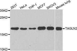 Western blot analysis of extracts of various cell lines, using TAGLN2 antibody. (TAGLN2 antibody)