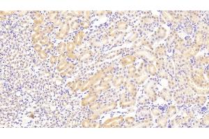 Detection of VCL in Mouse Kidney Tissue using Polyclonal Antibody to Vinculin (VCL) (Vinculin antibody  (AA 879-1064))