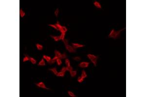 ABIN6272428 staining Hela by IF/ICC. (Septin 1 antibody  (Internal Region))