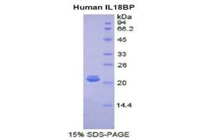 SDS-PAGE (SDS) image for Interleukin 18 Binding Protein (IL18BP) (AA 31-194) protein (His tag) (ABIN2121431) (IL18BP Protein (AA 31-194) (His tag))