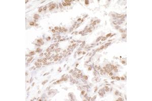 Immunohistochemistry (IHC) image for anti-H2A Histone Family, Member X (H2AFX) (C-Term) antibody (ABIN7453533) (H2AFX antibody  (C-Term))