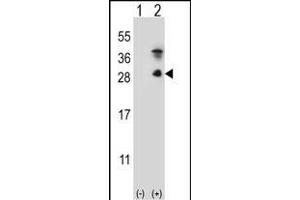 Western blot analysis of KLK7 (arrow) using rabbit polyclonal KLK7 Antibody  (ABIN652198 and ABIN2840744). (Kallikrein 7 antibody  (C-Term))