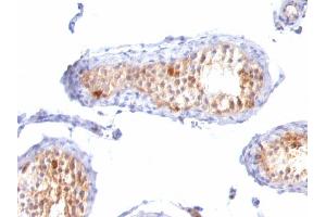 Formalin-fixed, paraffin-embedded human Testis stained with MART-1 / Melan-A Monoclonal Antibody (A103+M2-7C10+M2-9E3). (MLANA antibody)