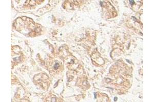 Immunohistochemical staining of formalin-fixed paraffin-embedded human fetal liver tissue showing membrane staining with AGPS polyclonal antibody  at 1 : 100 dilution. (AGPS antibody  (AA 462-632))