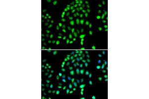 Immunofluorescence analysis of MCF-7 cells using PARP3 antibody (ABIN5974399). (PARP3 antibody)