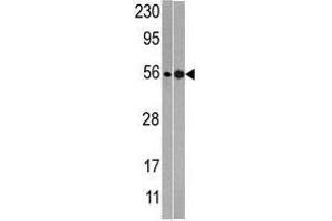 Image no. 1 for anti-60S Ribosomal Export Protein NMD3 (NMD3) (C-Term) antibody (ABIN357284) (NMD3 antibody  (C-Term))