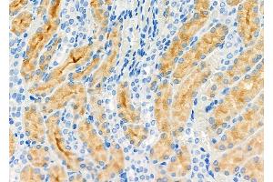 ABIN6258028 and ABIN6274976 at 1/100 staining Rat kidney tissue by IHC-P.