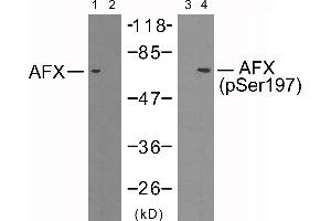 Western blot analysis of extracts from 293 cells using AFX (Ab-197) antibody (Line 1 and 2) and AFX (phospho-Ser197) antibody (Line 3 and 4). (FOXO4 antibody  (pSer197))
