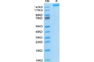 L1CAM Protein (AA 20-1123) (His tag)