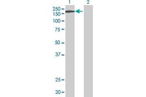 Western Blot analysis of A2M expression in transfected 293T cell line by A2M MaxPab polyclonal antibody. (alpha 2 Macroglobulin antibody  (AA 1-1474))