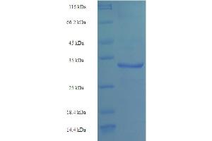 SDS-PAGE (SDS) image for LSM4 Homolog, U6 Small Nuclear RNA Associated (LSM4) (AA 1-139), (full length) protein (His-SUMO Tag) (ABIN5709883)