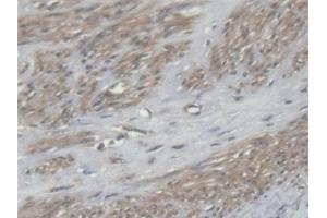 Immunohistochemistry (IHC) image for anti-Eukaryotic Translation Elongation Factor 2 (EEF2) (AA 32-233) antibody (ABIN7444787)