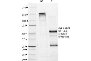 SDS-PAGE Analysis of Purified, BSA-Free Tyrosinase Antibody (clone T311).