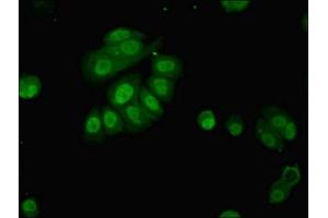 Immunofluorescent analysis of MCF-7 cells using ABIN7163605 at dilution of 1:100 and Alexa Fluor 488-congugated AffiniPure Goat Anti-Rabbit IgG(H+L) (PAFAH1B2 antibody  (AA 2-229))