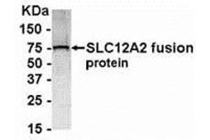 Western Blotting (WB) image for anti-Solute Carrier Family 12 (Potassium-Chloride Transporter) Member 2 (SLC12A2) (AA 800-1000) antibody (ABIN2468175) (SLC12A2 antibody  (AA 800-1000))
