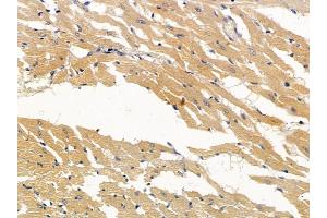 ABIN6256960 and ABIN6274918 at 1/100 staining rat heart tissue by IHC-P. (BMP10 antibody  (Internal Region))