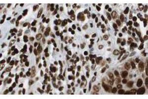 Immunohistochemistry (IHC) image for anti-Histone Deacetylase 1 (HDAC1) (AA 450-482) antibody (ABIN129652)