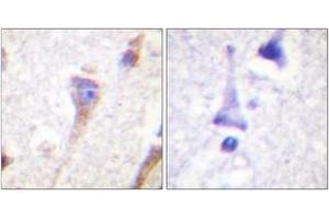 Immunohistochemistry analysis of paraffin-embedded human brain tissue, using PKD1/PKC mu (Ab-463) Antibody. (PKC mu antibody  (AA 429-478))