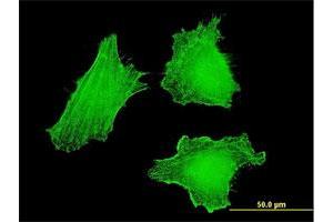 Immunofluorescence of monoclonal antibody to DLX5 on HeLa cell. (DLX5 antibody  (AA 1-110))