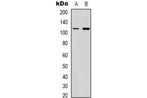 Western blot analysis of PI3K p110 gamma expression in Jurkat (A), NIH3T3 (B) whole cell lysates. (PIK3 gamma antibody)