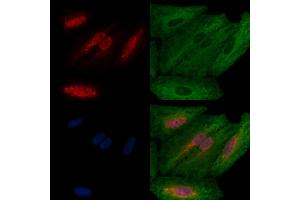 ABIN6257344 and ABIN6274221 staining  cells by IF/ICC. (MZF1 antibody  (N-Term))
