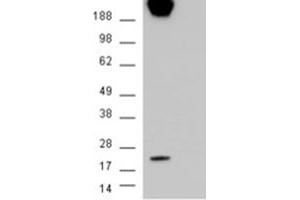 Image no. 3 for anti-Caveolin 1, Caveolae Protein, 22kDa (CAV1) (Internal Region) antibody (ABIN374578)