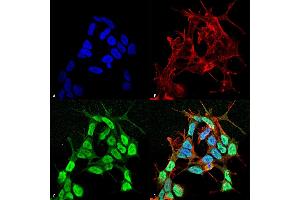 Immunocytochemistry/Immunofluorescence analysis using Mouse Anti-Nav beta 3 Monoclonal Antibody, Clone S396-29 (ABIN6932446). (SCN3B antibody  (AA 1-215) (Atto 488))